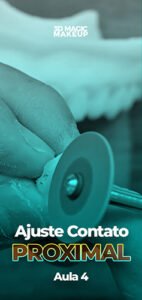 Capas Aulas - Ajuste do Contato Proximal