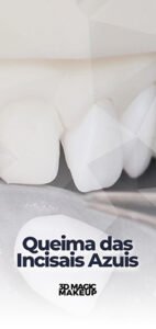 Capas Aulas E.Max CAD - Aula 10