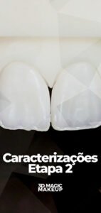 Capas Aulas E.Max CAD - Aula 13