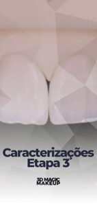 Capas Aulas E.Max CAD - Aula 16