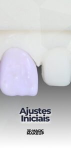 Capas Aulas E.Max CAD - Aula 3