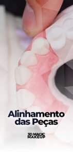 Capas Aulas E.Max CAD - Aula 4