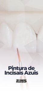 Capas Aulas E.Max CAD - Aula 9