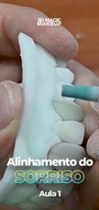 Capas Morfologia AdvancedAlinhamento do sorriso